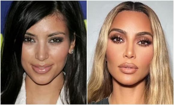Kim Kardashian, khuôn mặt của Kim Kardashian thay đổi trong những năm qua, Kim Kardashian gây chú ý về ngoại hình