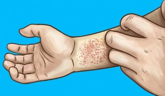suy thận, bệnh thận, dấu hiệu bệnh thận