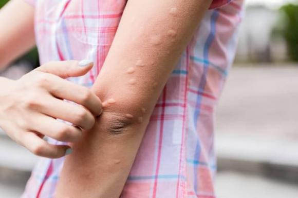 muỗi, sốt xuất huyết, đuổi muỗi bằng dầu gió