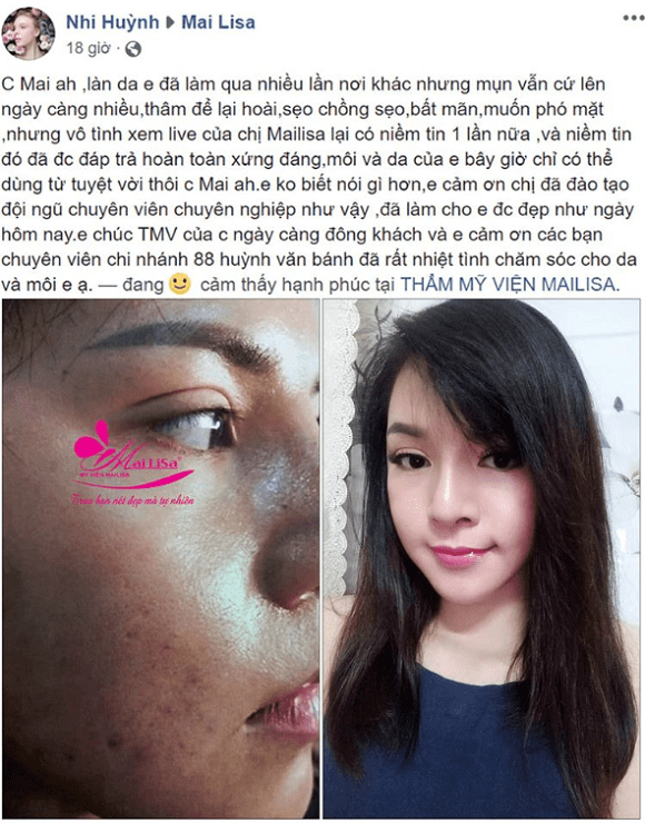 Mailisa, Thẩm mỹ viện Mailisa