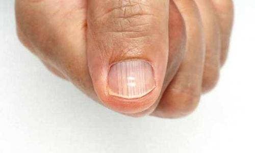 ngón tay, dấu hiệu bệnh, sức khỏe