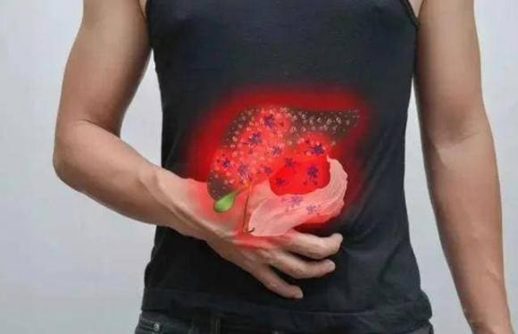 bệnh gan, dấu hiệu bệnh, dấu hiệu bệnh gan, ngứa ngáy