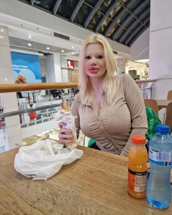búp bê Barbie ngoài đời thực, Andrea Emilova Ivanova, phẫu thuật thẩm mỹ