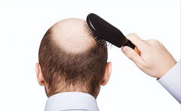 lão hóa, trình tự lão hóa, lão hóa cơ thể