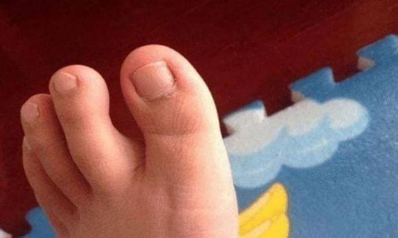 đũa mốc, đĩa nhựa, đồ vật gây ung thư