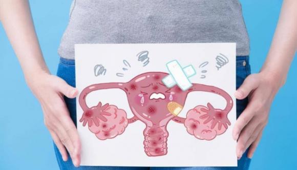 cổ tử cung, virus hpv, ngứa vùng kín