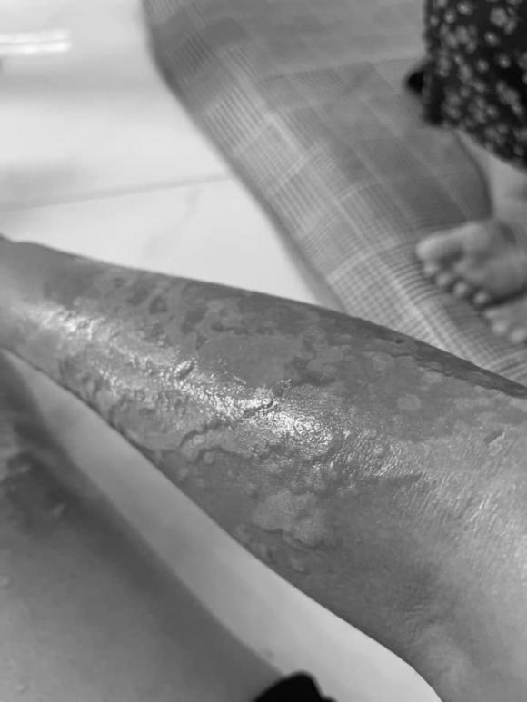 thông cống, dùng chất thông cống, giới trẻ 
