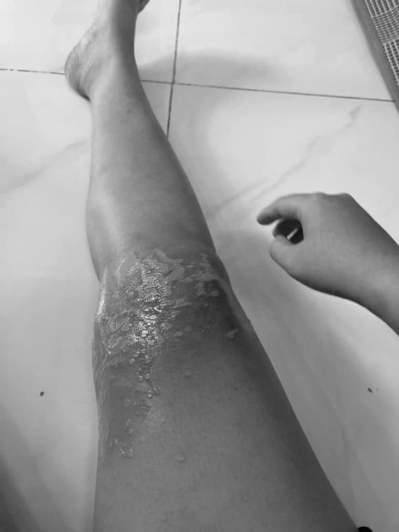 thông cống, dùng chất thông cống, giới trẻ 