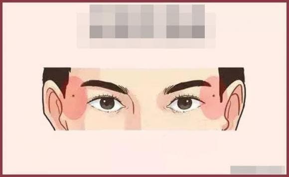 nốt ruồi, tướng số, vị trí nốt ruồi