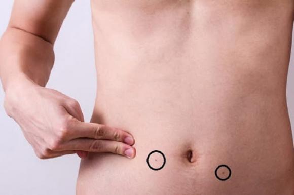 nốt ruồi, tướng số, vị trí nốt ruồi