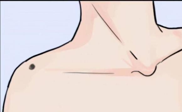 nốt ruồi, vị trí nốt ruồi