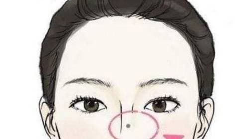 nốt ruồi, vị trí nốt ruồi