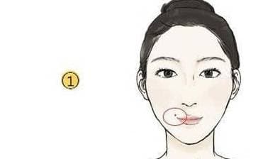 nốt ruồi, vị trí nốt ruồi