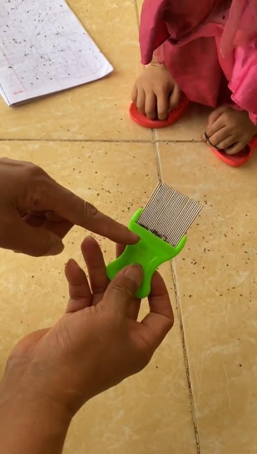 con chấy, chấy ở trên tóc, nguyên nhân bị chấy