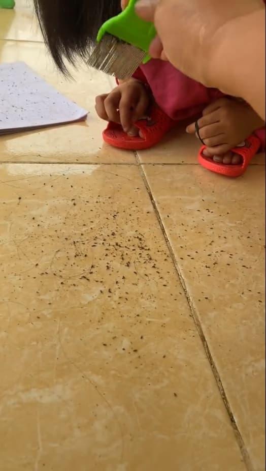 con chấy, chấy ở trên tóc, nguyên nhân bị chấy