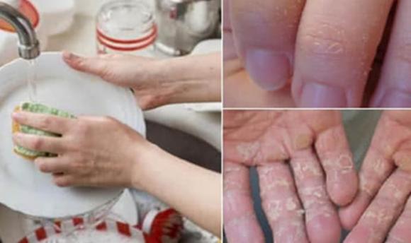 Rửa bát bằng tay cần tránh 6 sai lầm dưới đây, vừa tốn tiền vừa gây hại cho làn da