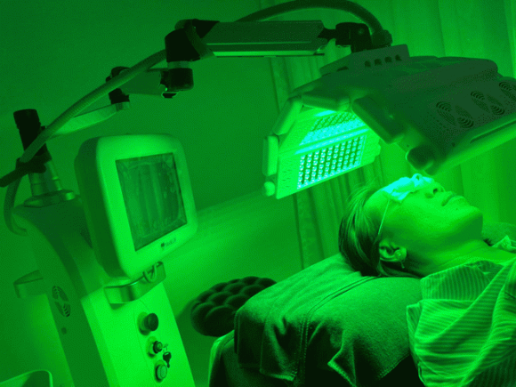 Hồng Chuyên Clinic, Medilux, Công nghệ LED 05 bước sóng chuẩn y khoa, điều trị da, MediLUX