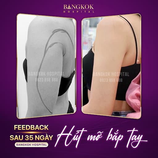 Tham-my-Bangkok-1.jpg 0 Thẩm mỹ Bangkok, Thẩm Mỹ, Làm Đẹp, Bangkok