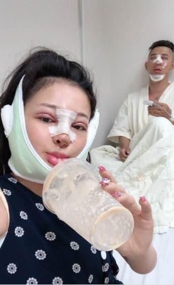 Trước đó hồi 2019, cô nàng từng tiết lộ cùng Lương Bằng Quang sửa mắt, mũi, cằm để gương mặt được hài hòa.