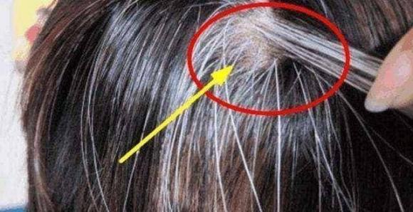 tóc bạc, bạc tóc