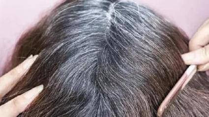 tóc bạc, bạc tóc