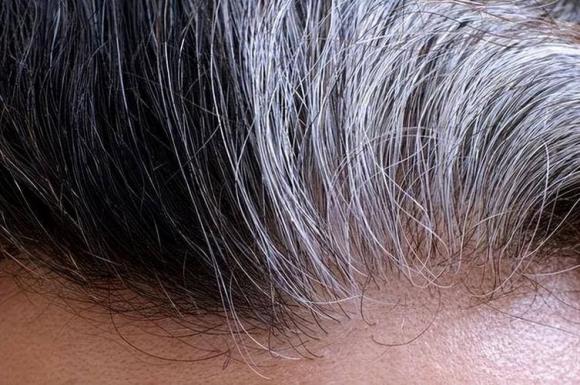 tóc bạc, bạc tóc