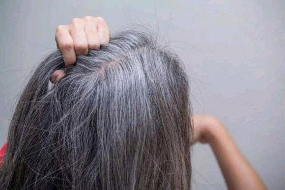 tóc bạc, bạc tóc