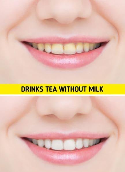 chăm sóc răng, răng trắng khỏe, sức khỏe 