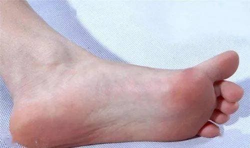 phụ nữ sống thọ, sống thọ, đặc điểm phụ nữ sống thọ