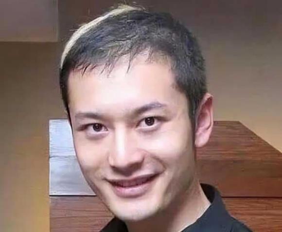 sao hoa ngữ, sao hoa ngữ thẩm mỹ, mặt thật của sao