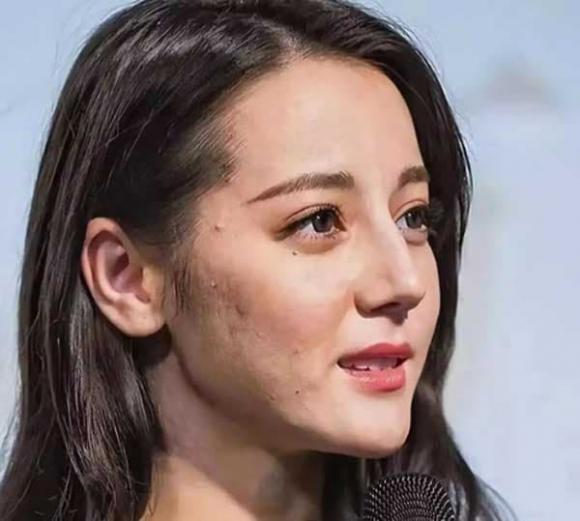 sao hoa ngữ, sao hoa ngữ thẩm mỹ, mặt thật của sao