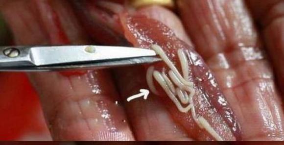 Thịt chứa ký sinh trùng rất dễ nhận biết bằng cách này, ăn phải thịt nhiễm bẩn, cơ thể có dấu hiệu gì?