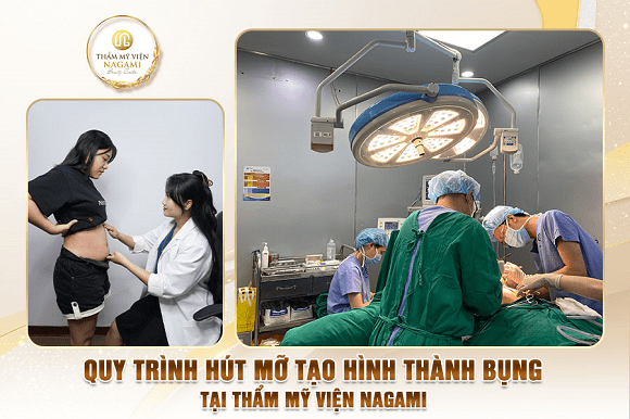 Nagami, TMV Nagami, hút mỡ bụng, tái tạo vòng 2