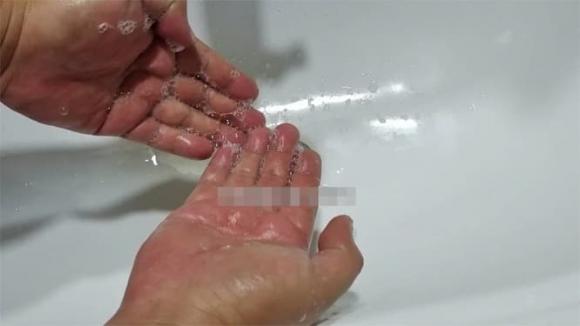 View - Dùng xà phòng hay sữa tắm khi tắm tốt hơn? Nhiều người sử dụng sai cách, chẳng trách làn da của họ lại trở nên tệ hơn