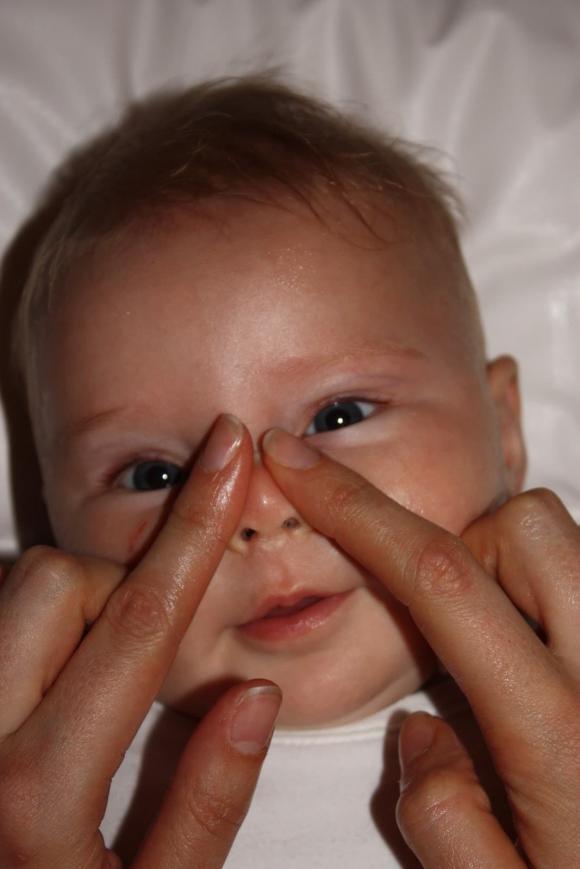 vuốt mũi cho trẻ sơ sinh, trẻ sơ sinh, sống mũi cao