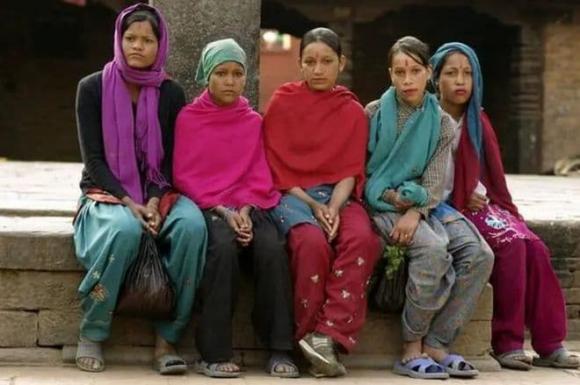 View - Làng bán thận ở Nepal: Dân làng tin rằng thận sẽ mọc lại sau khi bị cắt và ai cũng có vết sẹo trên cơ thể