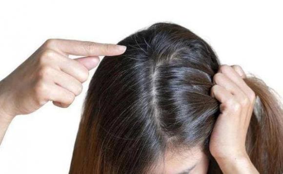 View - Thiếu vitamin nào sẽ khiến tóc bạc sớm? Tóc bạc có nhổ được không? Bạn sẽ hiểu sau khi đọc bài viết này 