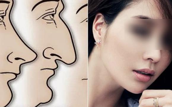  tướng mũi, hình dạng mũi, kiến thức 