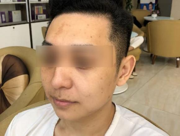 tướng mũi, hình dạng mũi, kiến thức 