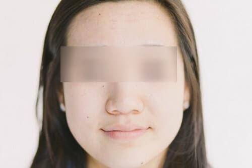  tướng mũi, hình dạng mũi, kiến thức 