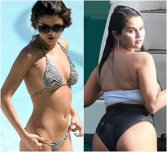 Selena Gomez, sao Hollywood, mắc bệnh lupus ban đỏ