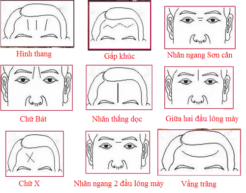 Cưới vợ tránh xa môi trề, lấy chồng thì né trán nhăn, người xưa dạy, lời cổ nhân, các cụ dặn con cháu