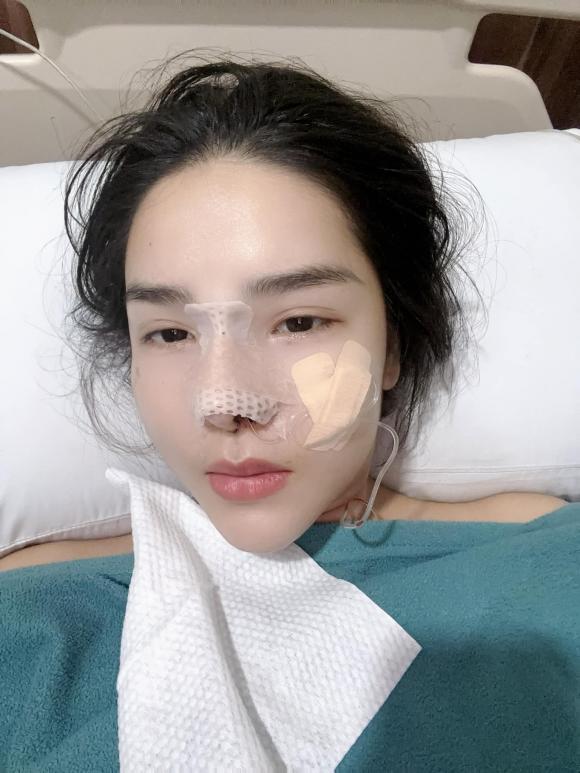 View - Chuyện làm đẹp mũi của sao Việt: Kỳ Hân bị chê; Pha Lê chịu 'đau tới não' khi tháo sụn vì bị viêm 