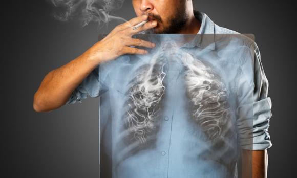 tác hại của thuốc lá, cai thuốc lá, cách bỏ thuốc lá