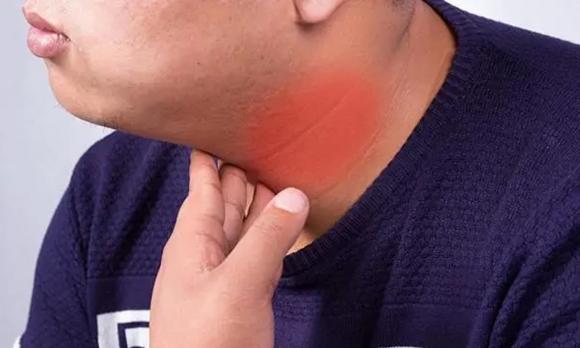 u tuyến giáp, u tuyến giáp nên ăn gì