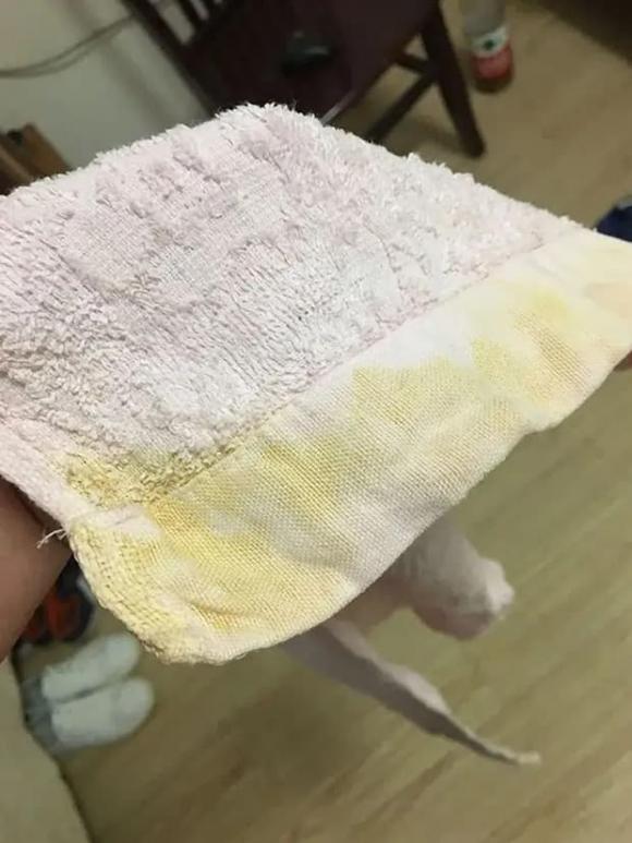 giặt khăn ố vàng, mẹo giặt khăn ố vàng, làm sạch khăn ố vàng