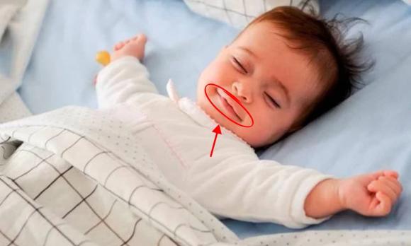son đỏ trên trán trẻ sơ sinh, chấm son đỏ trên trán trẻ sơ sinh, chấm son đỏ trên trán trẻ sơ sinh làm gì