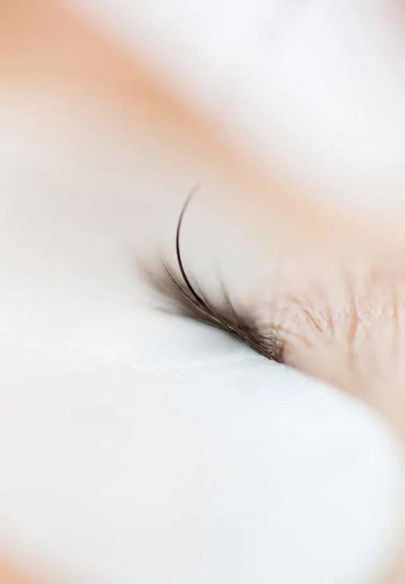 phụ nữ nhiều lông, lông vùng kín