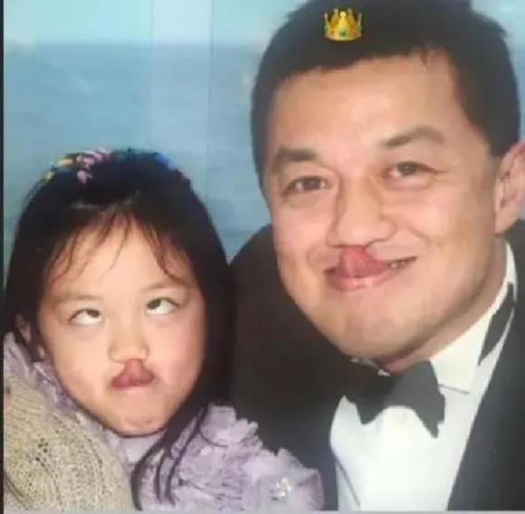 lý yên, vương phi, lý á bằng, con gái hở hàm ếch, sao hoa ngữ