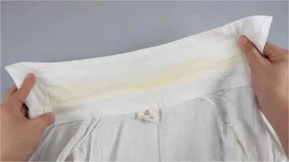 Cổ áo sơ mi trắng, vết ố vàng